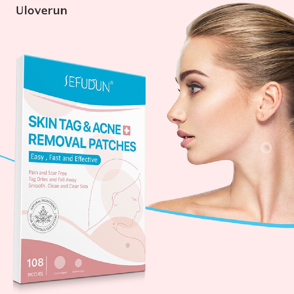 Bộ 108 Miếng Dán Loại Bỏ Mụn Trứng Cá / Mụn Trứng Cá Tiện Dụng