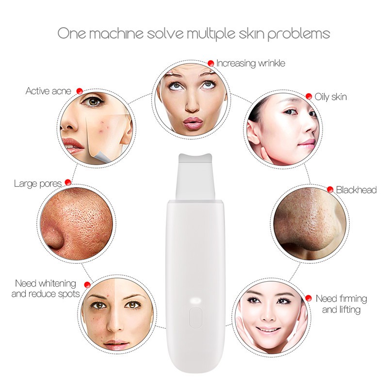 [Mã FMCGMALL - 8% đơn 250K] Máy làm sạch da mặt CkeyiN bằng sóng siêu âm | BigBuy360 - bigbuy360.vn