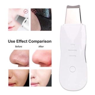 Máy matxa thải độc chì