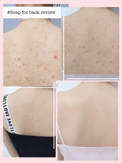 Xịt giảm thâm mụn lưng For Back