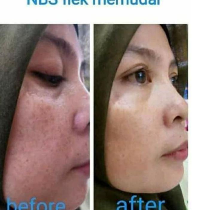 Bình Xịt Làm Đẹp Tự Nhiên 100%EF39 (Trims,.) | BigBuy360 - bigbuy360.vn