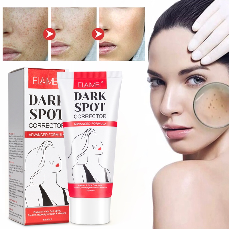 Kem Dưỡng Trắng Da YOUYO Loại Bỏ Nám Tàn Nhang Đốm Đen Làm Sáng Da Chống Lão Hóa