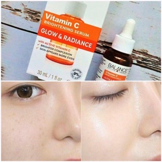 Serum Blance Vitamin C