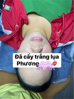 Cấy trắng spa handmade