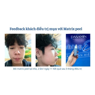 Serum mụn mờ thâm sạm dasamin matrix peel 30ml