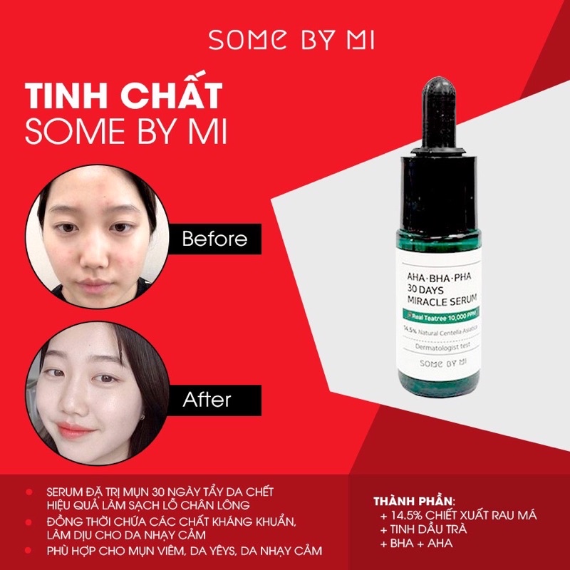 Bộ Kit Some By Mi Miracle Starter Kit cho da dầu mụn (4 Items)