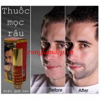Serum Mọc Râu Hàm Ấn Độ