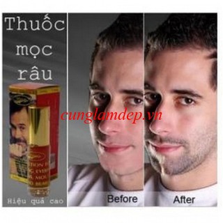 Serum Mọc Râu Hàm Ấn Độ