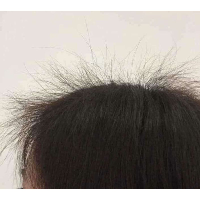 Tinh dầu bưởi - Xịt bưởi thảo dược kích mọc tóc | BigBuy360 - bigbuy360.vn