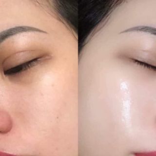 SAMPLE TẨY DA CHẾT PELL KOREA