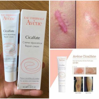 Kem phục hồi da làm lành sẹo Avene Cicalfate Restorative Skin Cream 40ml