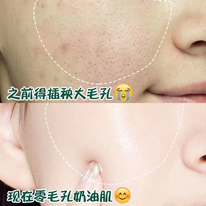 Kem Dưỡng Ẩm Thu Nhỏ Lỗ Chân Lông Trị Mụn Đầu Đen Hiệu Quả maanshanzc.my11.27 | BigBuy360 - bigbuy360.vn
