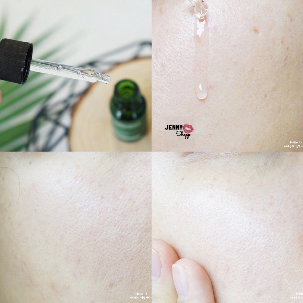 Bộ Dưỡng Da Tràm Trà Giảm Mụn Caryophy