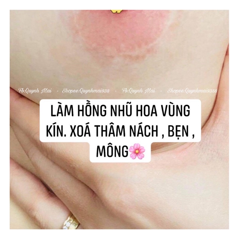 PEEL LỘT THÂM NÁCH, MÔNG, BẸN, HỒNG TI, VÙNG KÍN...