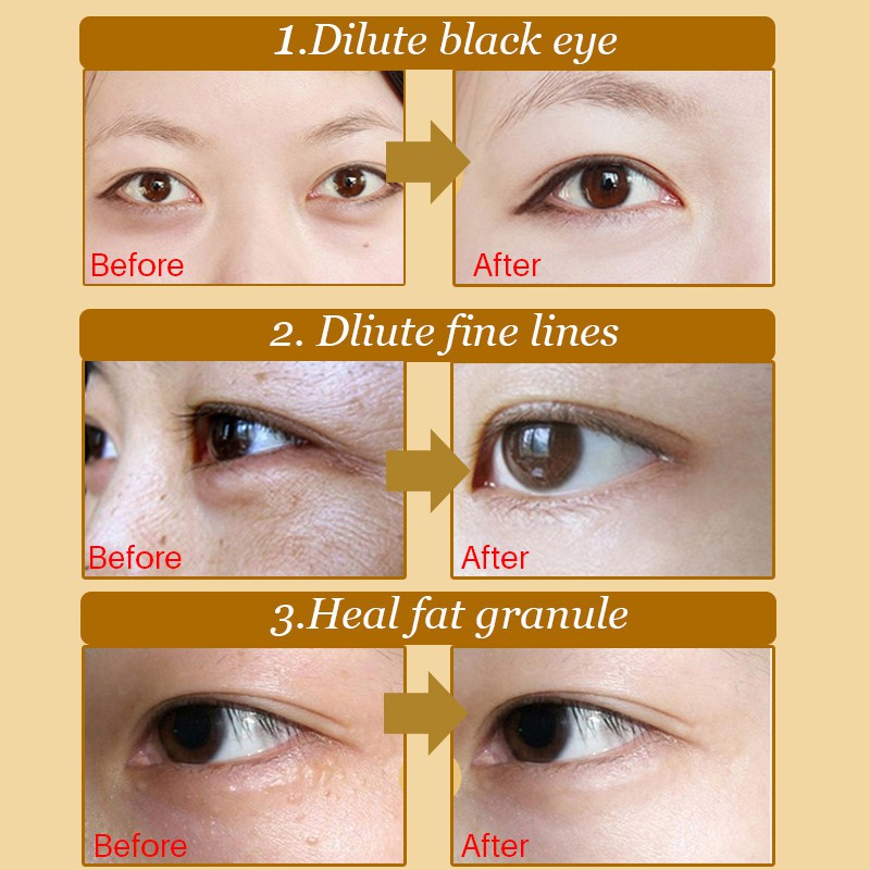 Mặt nạ mắt bổ sung collagen chống lão hóa chăm sóc da phong cách Hàn Quốc | WebRaoVat - webraovat.net.vn