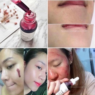 Serum tẩy tế bào chết hoá học peel da THE ORDINARY AHA 30% + BHA 2% Peeling Solution 30ml