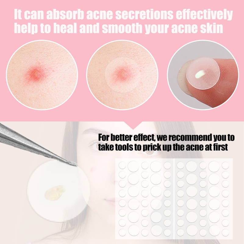 Set 36 Miếng Dán Hỗ Trợ Giảm Mụn Vô Hình Làm Đẹp Chăm Sóc Da