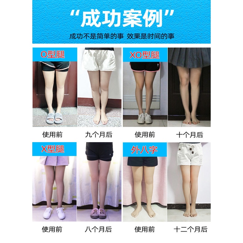 Dụng Cụ Chỉnh Hình Chân Thẳng Hình Chữ O XO XO Tiện Dụng