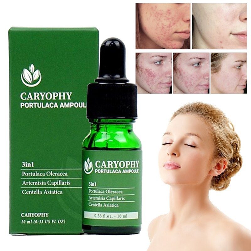 Serum Ngừa Mụn Mờ Thâm Caryophy Portulaca Ampoule 10ml