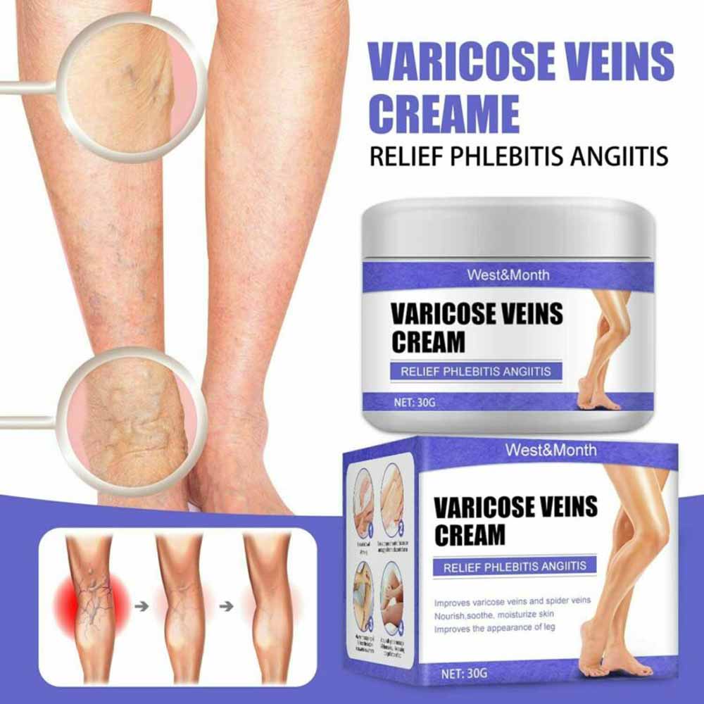 Vein Care Fading Cream Varicose Veins Cream for Legs Veins Herbal Ointment