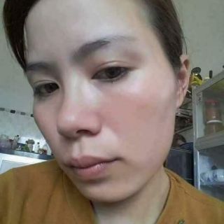 Bộ Kem Nám Vick White Beck ( trắng da mờ nám)