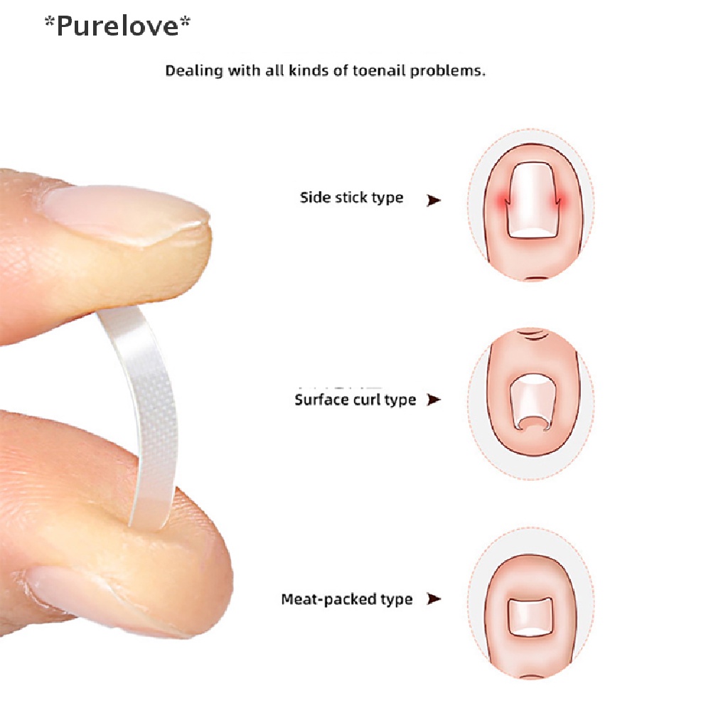 Set 10 Miếng Dán Móng Chân Hỗ Trợ Giảm Bệnh Nấm Móng Tiện Dụng