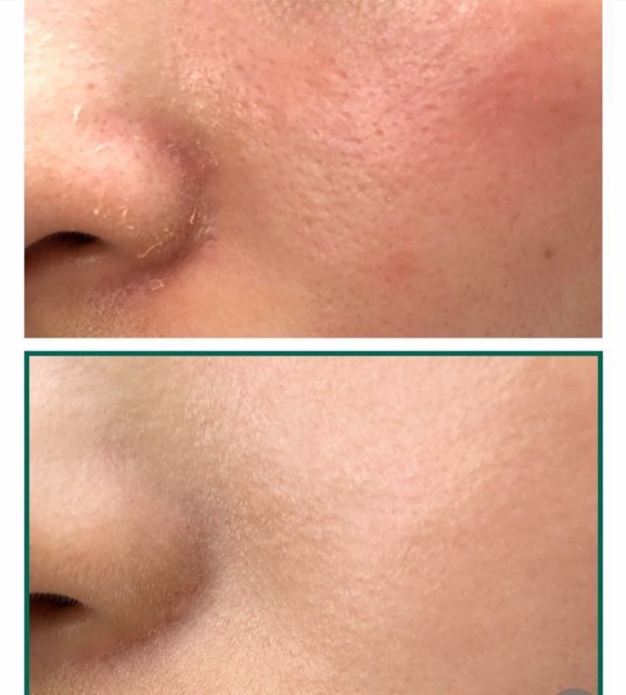 Nước hoa hồng da mụn AHA-BHA-PHA 30 Days Miracle Toner Some By Mi | BigBuy360 - bigbuy360.vn