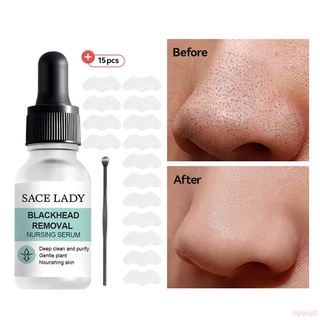 SACE LADY10ml Mụn Đầu Đen Chất Rõ Ràng Lớp Biểu Bì Giữ Ẩm, Sửa Chữa SL904 upbest