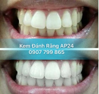 Kem Đánh Răng AP24 Ban Đêm