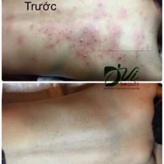 Sữa Tắm Kén Tằm DVi nature
