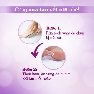 Kem Nứt Gót ORISS