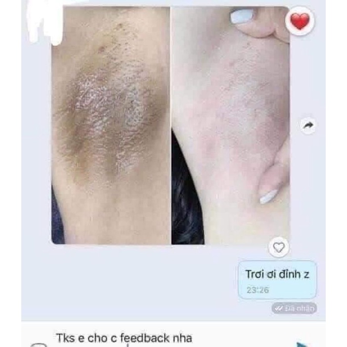 Thâm nách, Kem Dưỡng Trắng Da vùng Nách giảm thâm đầu gối,khuỷu tay,mông Q-NIC Care Thái Lan