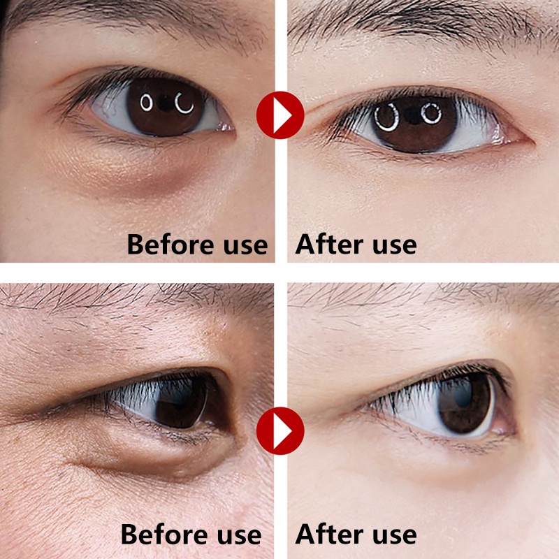 1 Mặt Nạ Mắt Chiết Xuất Nhân Sâm Đỏ Collagen Dưỡng Ẩm Xóa Quầng Thâm Chống Lão Hóa