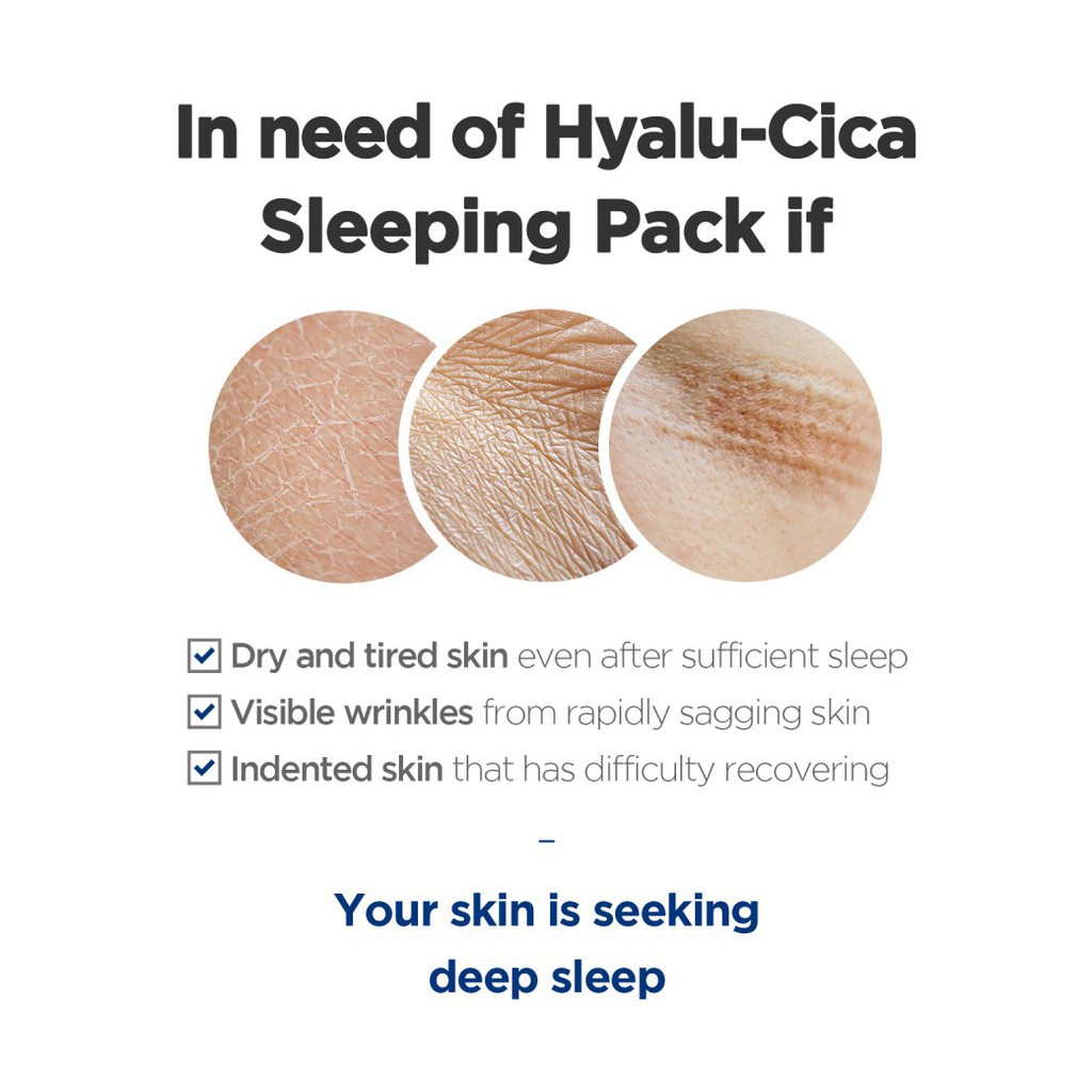 Mặt nạ ngủ giúp cấp ẩm, giảm thâm, mờ nếp nhăn Skin1004 Madagascar Centella Hyalu-cica Sleeping Pack 100ml