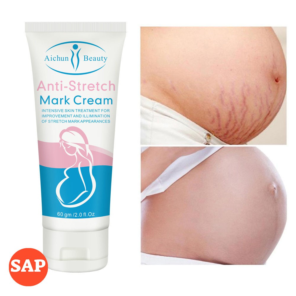 Kem làm mờ rạn da, kem tái tạo da hiệu quả cho bà bầu Anti-stretch Marks Cream - mờ sẹo, giảm thâm, giảm nhăn hiệu quả