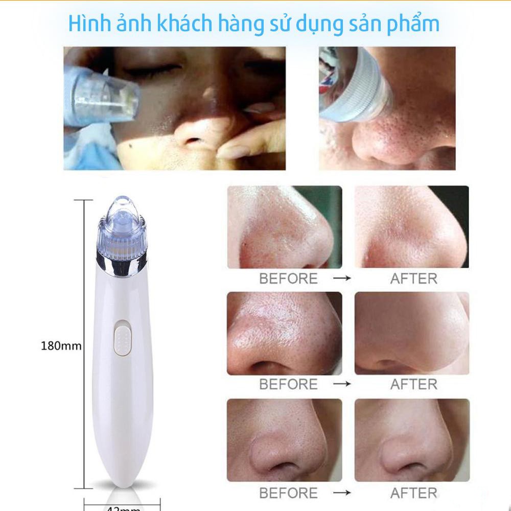 Máy hút mụn mini cao cấp sử dụng pin rời, an toàn hiệu quả, bảo hành 12 tháng