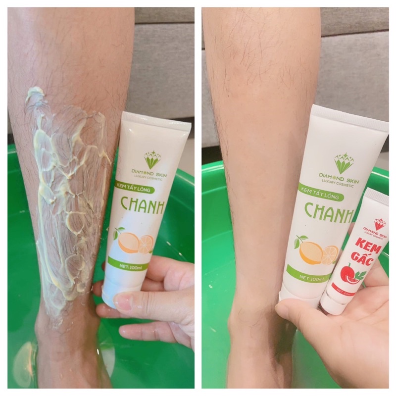  Kem tẩy lông chanh gấc Diamond Skin | BigBuy360 - bigbuy360.vn