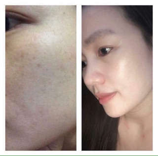 Face trắng hồng HM STORE