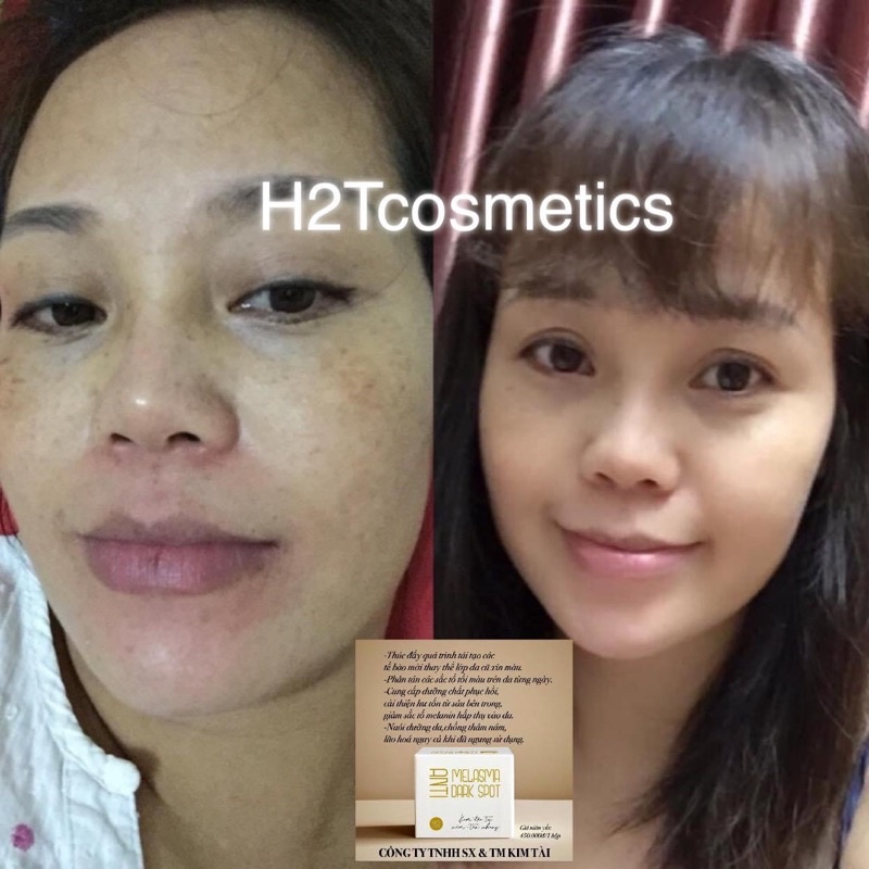 Tinh chất dưỡng trắng da chống lão hoá xoá nám tàn nhang hack tuổi làm da ❤️FREESHIP❤️lưu giữ nét thanh xuân | BigBuy360 - bigbuy360.vn