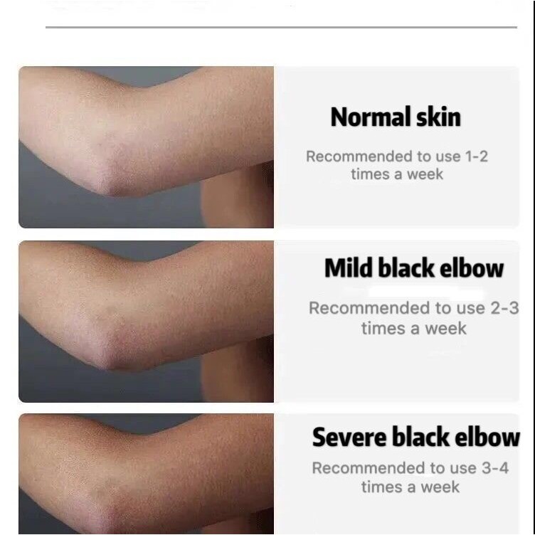 Kem làm trắng da vùng dưới cánh tay/ đầu gối/ chân/ vùng kín 70g tiện dụng