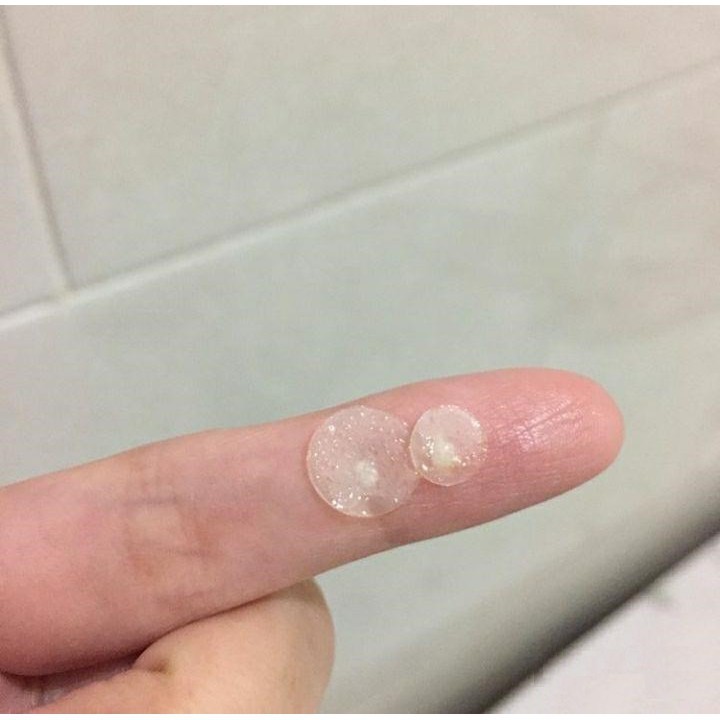 Hộp 12 miếng dán mụn Acnes Clear Patch - ngừa thâm mụn hiệu quả | BigBuy360 - bigbuy360.vn