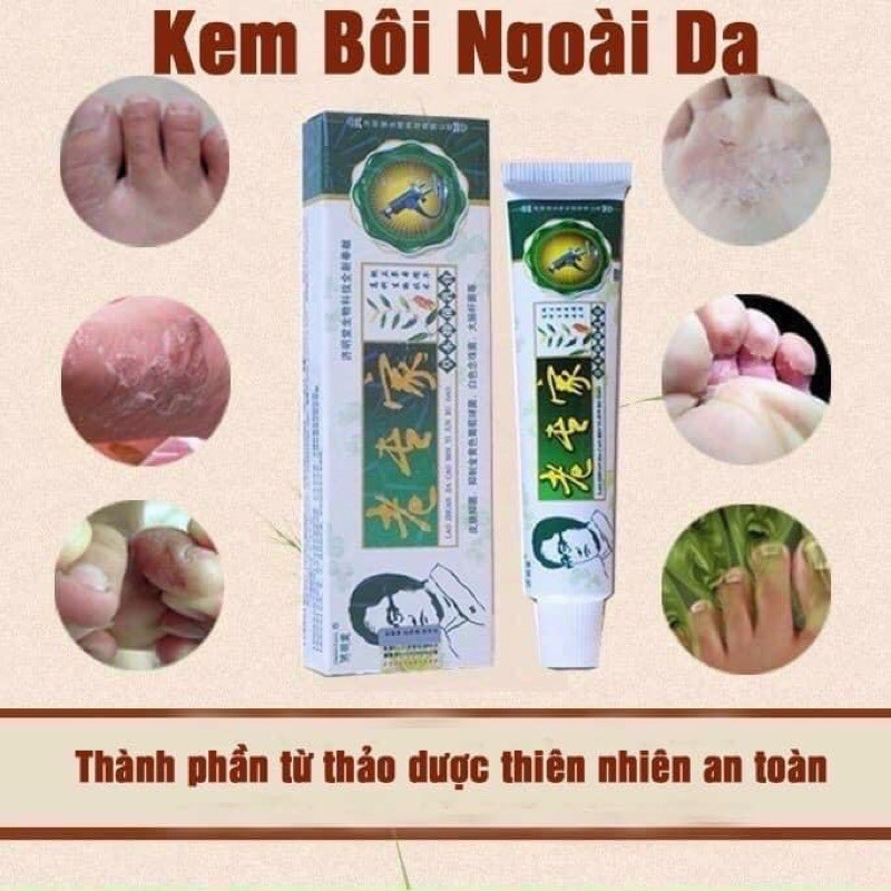 KEM BÔI NỨT NẺ CHÂN TAY THẦN THÁNH ( tuýp xanh )