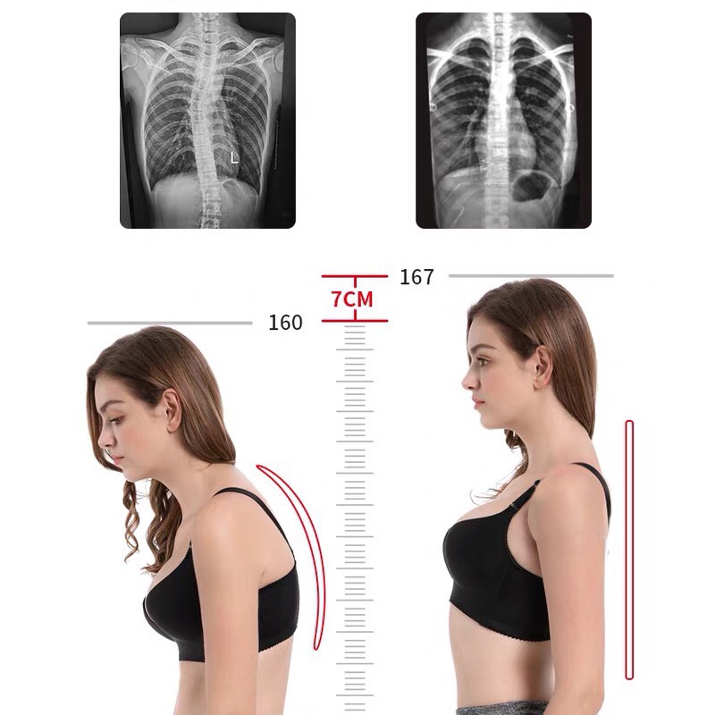 Đai Chống Gù Lưng Đai Lưng Bảo Vệ Cột Sống Có Thể Điều Chỉnh Kích Thước KHO GIA DỤNG TRẦN PHÚ