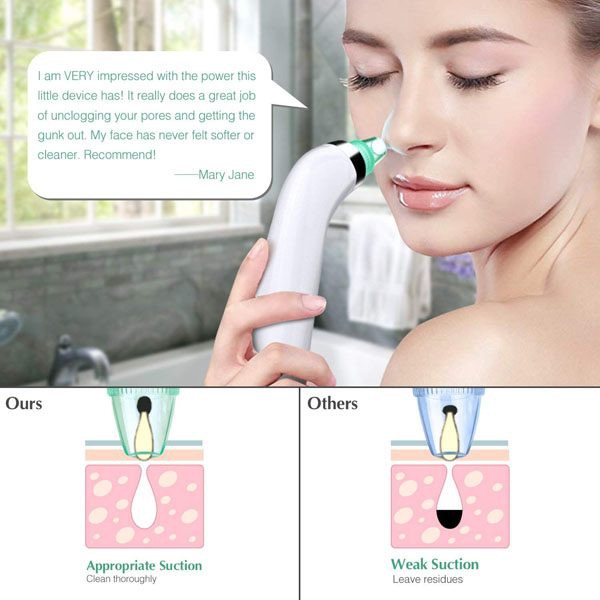 Máy Hút Mụn Cầm Tay Derma Suction Cao Cấp, Dụng Cụ Hút Da Dầu, Mụn Đầu Đen, Trứng Cá  Tặng kèm đầu hút và cây lặn mụn