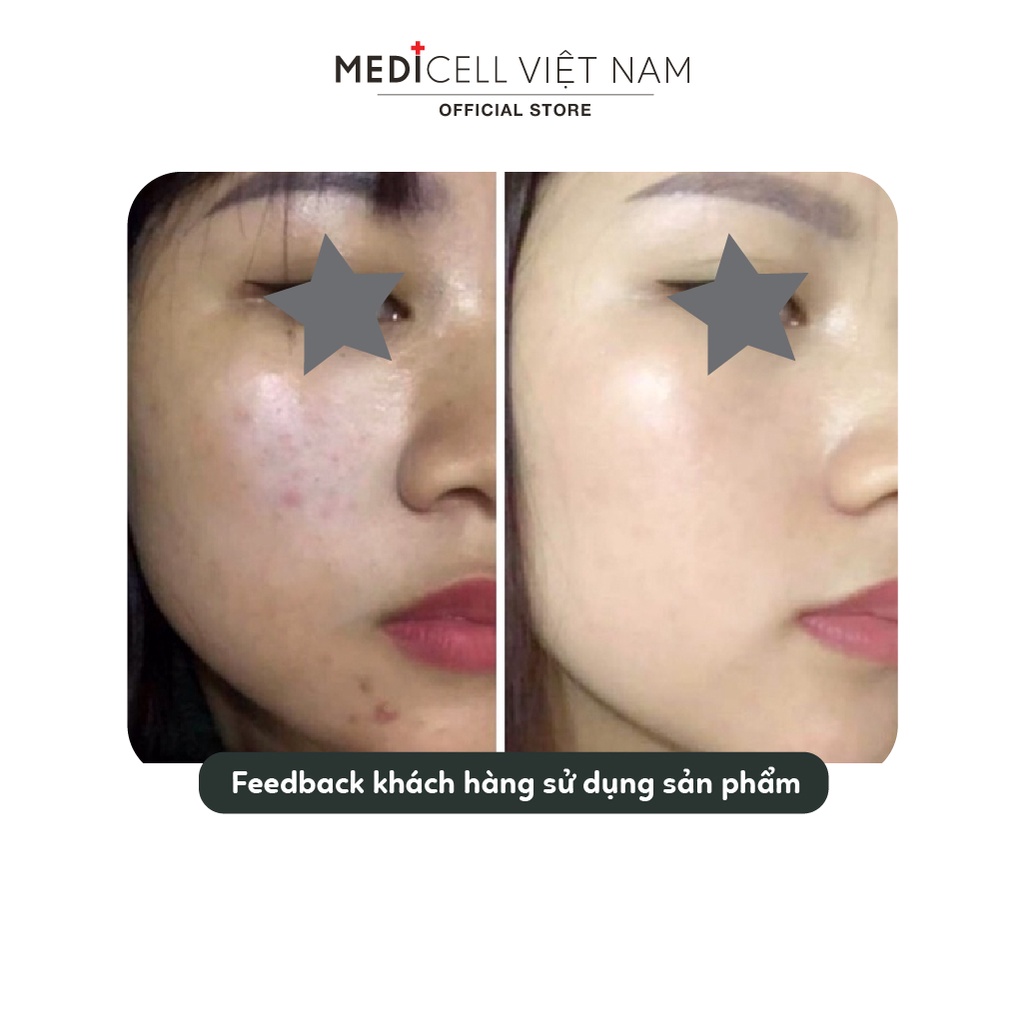 Serum DN Brightening Medicell, dưỡng trắng da, giảm mụn, kiềm dầu - Chai 30ml