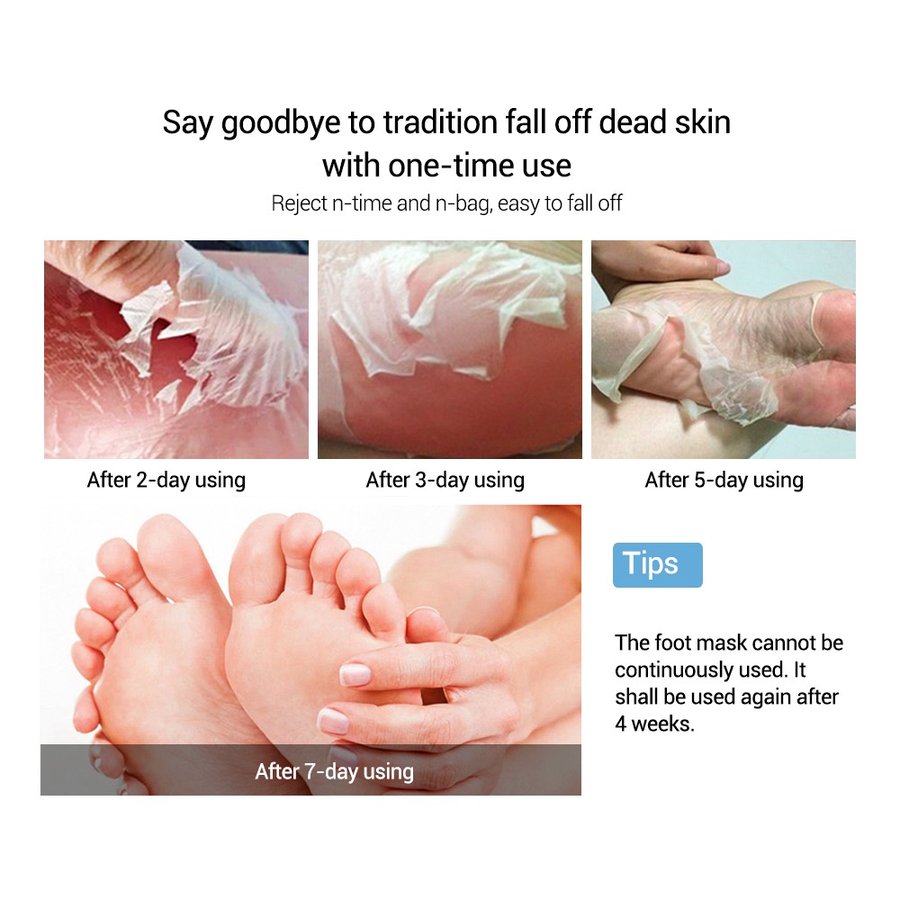 Set 2 mặt nạ LANBENA tẩy tế bào chết làm giảm vết chai hiệu quả cho chân
