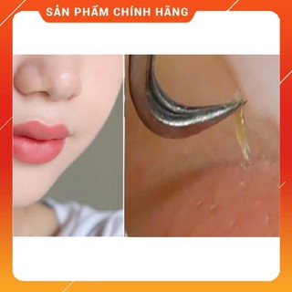 Nhíp Gắp Mụn Lucky