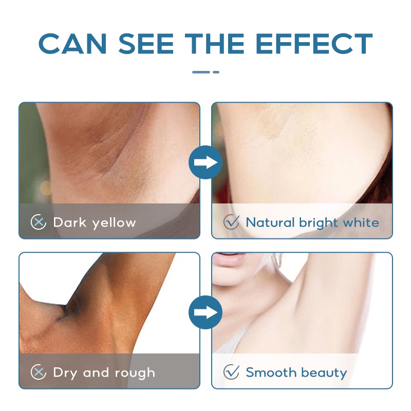 RUOALL Kem Làm Trắng Sáng Da Vùng Dưới Cánh Tay / Đầu Gối / Khuỷu Tay / Vùng Bikini / Vùng Da Dưới Cánh Tay Không Làm Mờ Vết Thâm 50g
