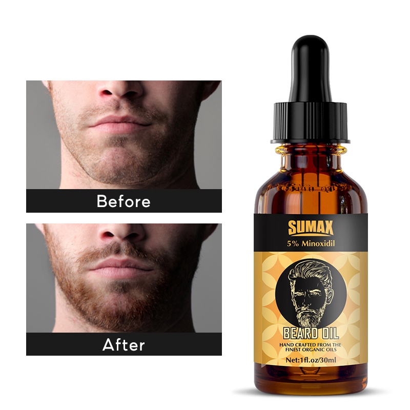 RUOALL Tinh Dầu Kích Thích Mọc Râu 5% Minoxidil Dành Cho Nam 30G