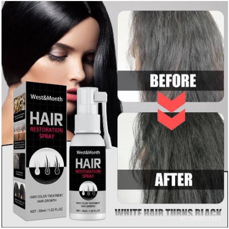 Chai Xịt Kích Thích Mọc Tóc Màu Trắng Đen 30ml Tiện Dụng